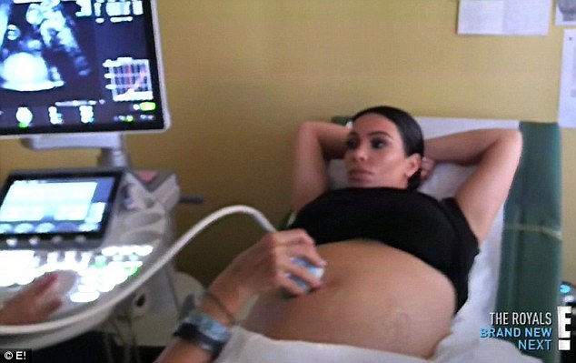The Breech Birth of Kim Kardashian's Baby: A Moment of Vulnerability