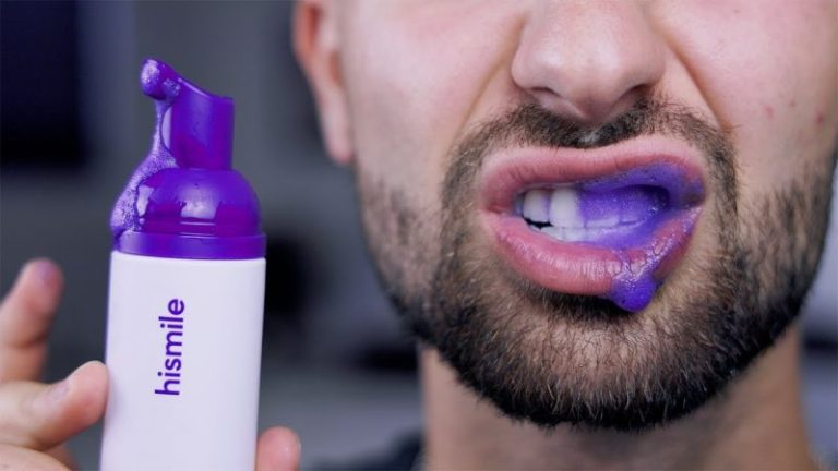 The Rise of Purple Teeth Whitening and the Influence of Kim Kardashian’s Teeth 