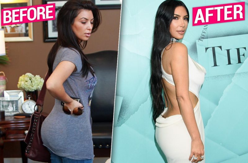 Kim Kardashian Implant Removal: Has the Reality Star Finally Gone Au Naturel?