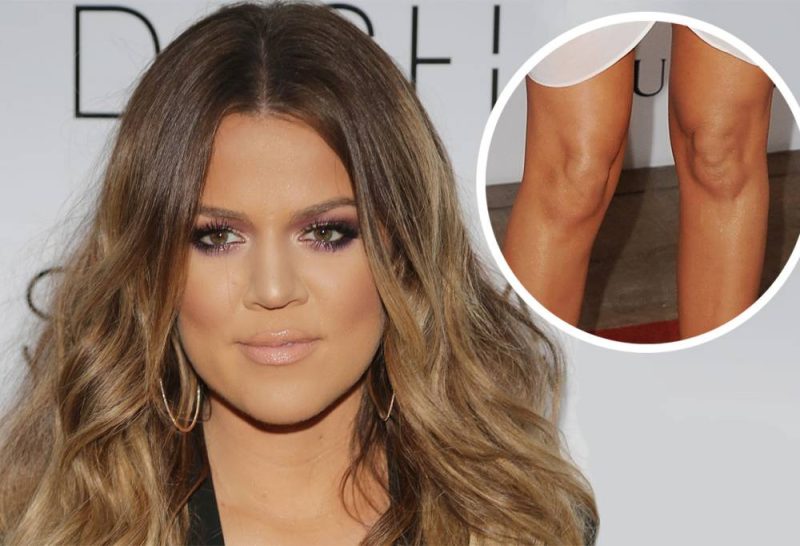 The Khloe Kardashian Car Accident in 2014: A Harrowing Incident