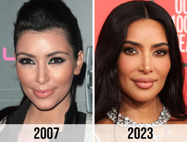 Kim Kardashian Before Plastic Surgery: A Glimpse into Her Natural Beauty 