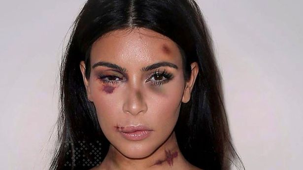 The Shocking Incident: Kim Kardashian Beaten by Ex - A Disturbing Reality