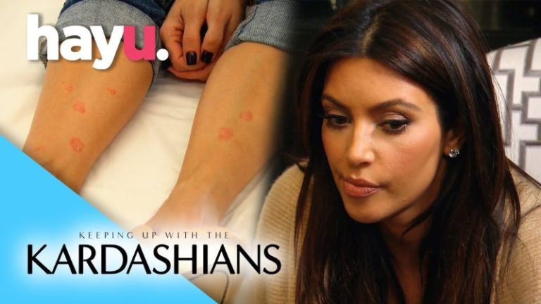 The Impact of Kim Kardashian’s Psoriasis Episode on YouTube 