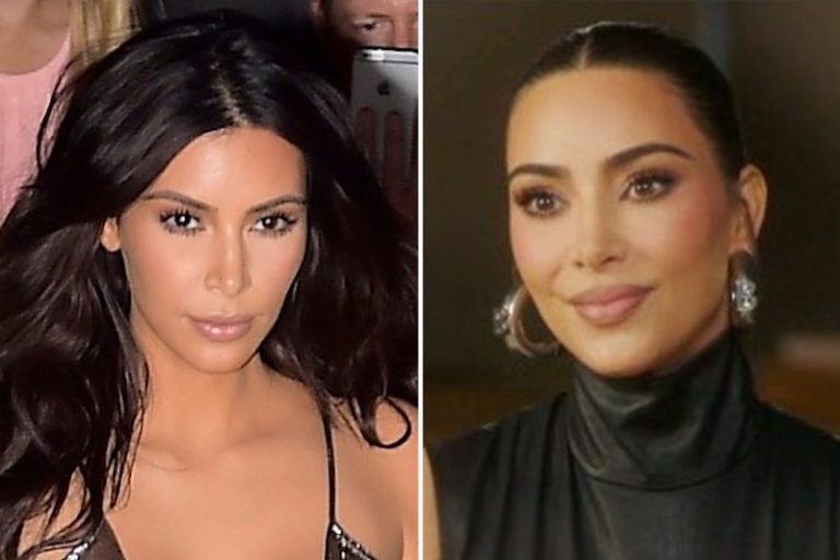 The Kim Kardashian Lip Lift: A Beauty Trend Worth Considering? 